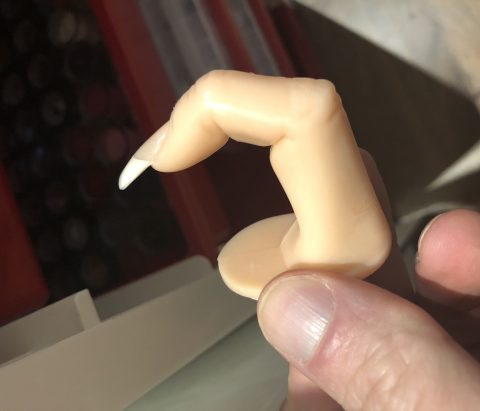 Wenn der Anus kratzt…